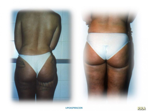 Slider image (4) ProEsthetik